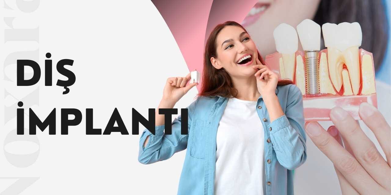 Diş İmplantı