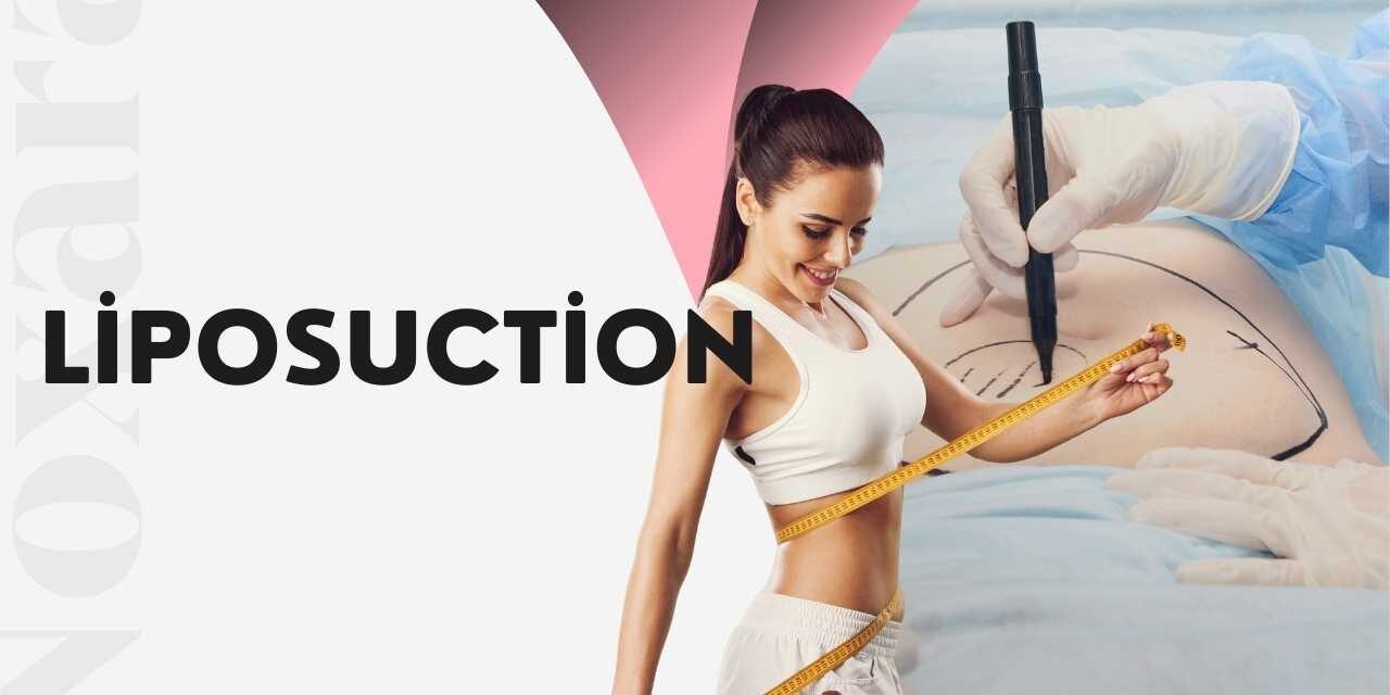 Liposuction